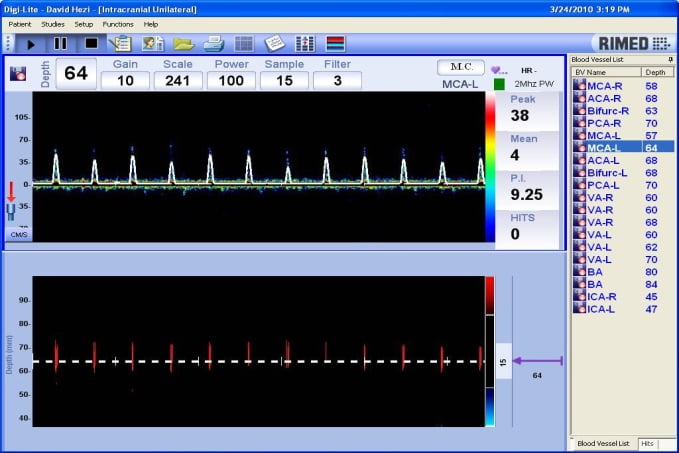 short_systolic_spikes